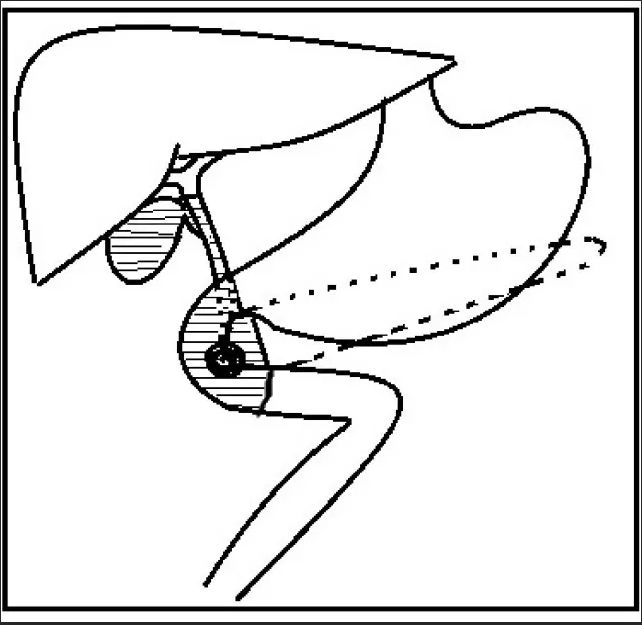 ny25_166697.jpg b5.jpg