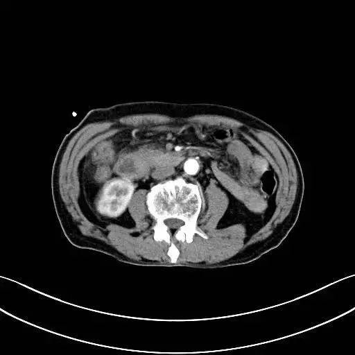 ny25_736790.jpg b8.jpg