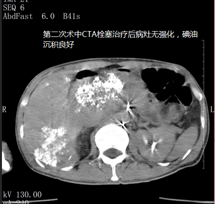 ny08_617735.png v18.png