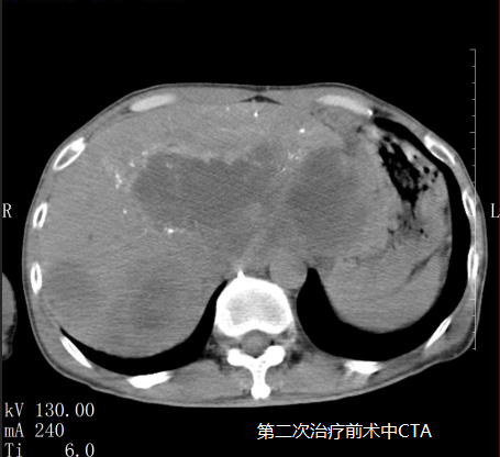 ny08_711573.png v17.png