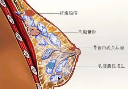 复大乳腺病中心提醒您,这些误区不要踩!