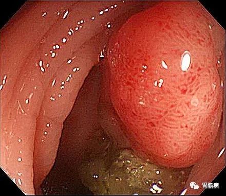 ny27_753126.jpg b15.jpg