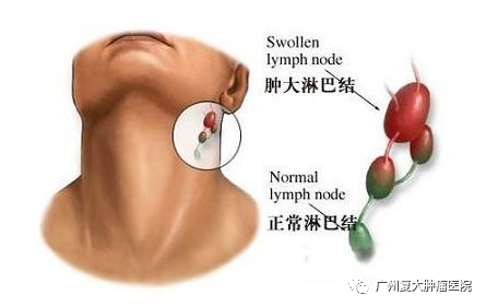 ny11_501195.png m2.png