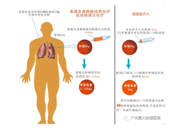 ny17_828322.jpg vv12.jpg