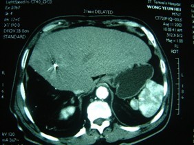 ny12_850731.jpg 20140704104123556.jpg