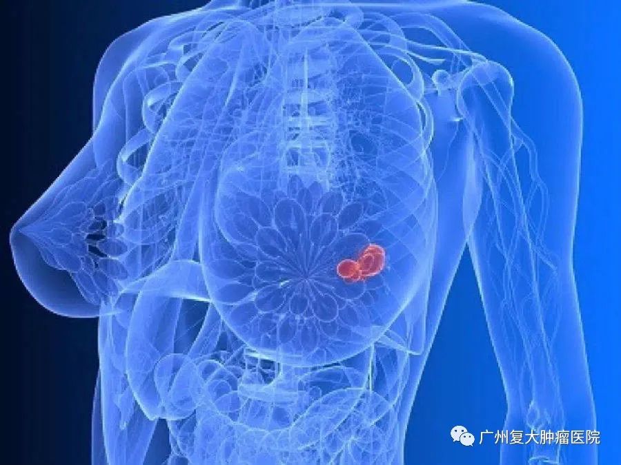 ny17_268463.jpg cb2.jpg