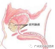 ny20_593253.png gf2.png