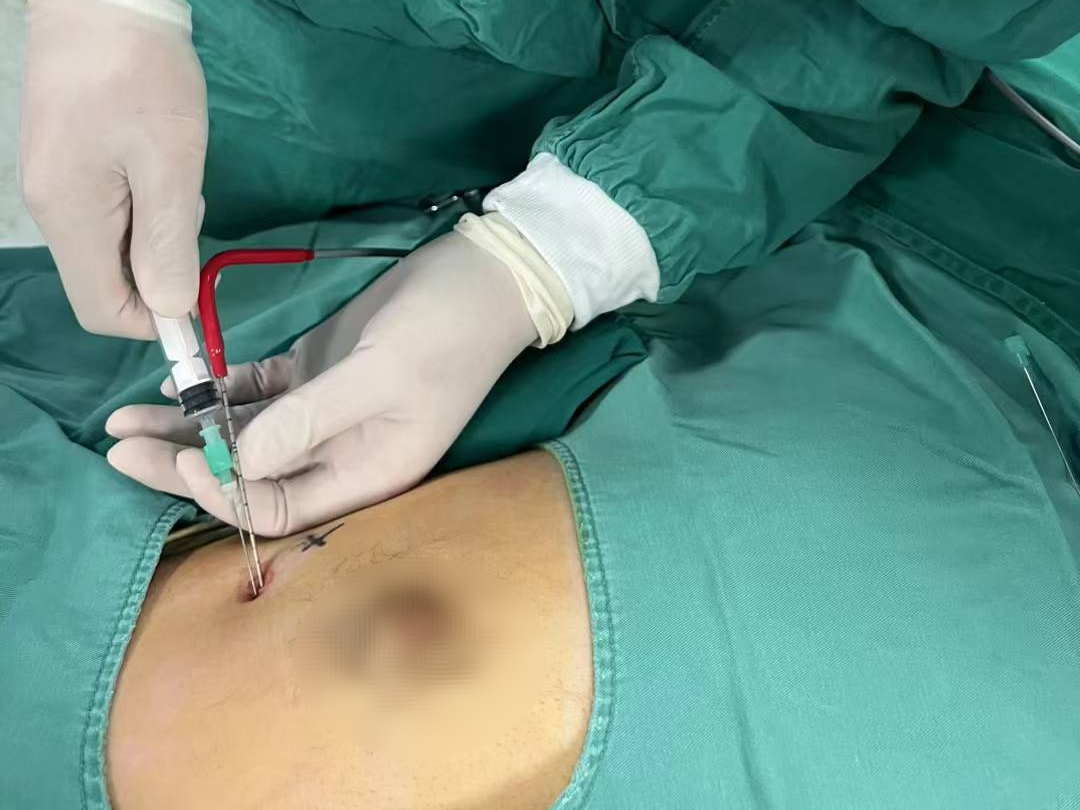 f550b665974c91a1f516113a1d36ace8.jpg f550b665974c91a1f516113a1d36ace8.jpg